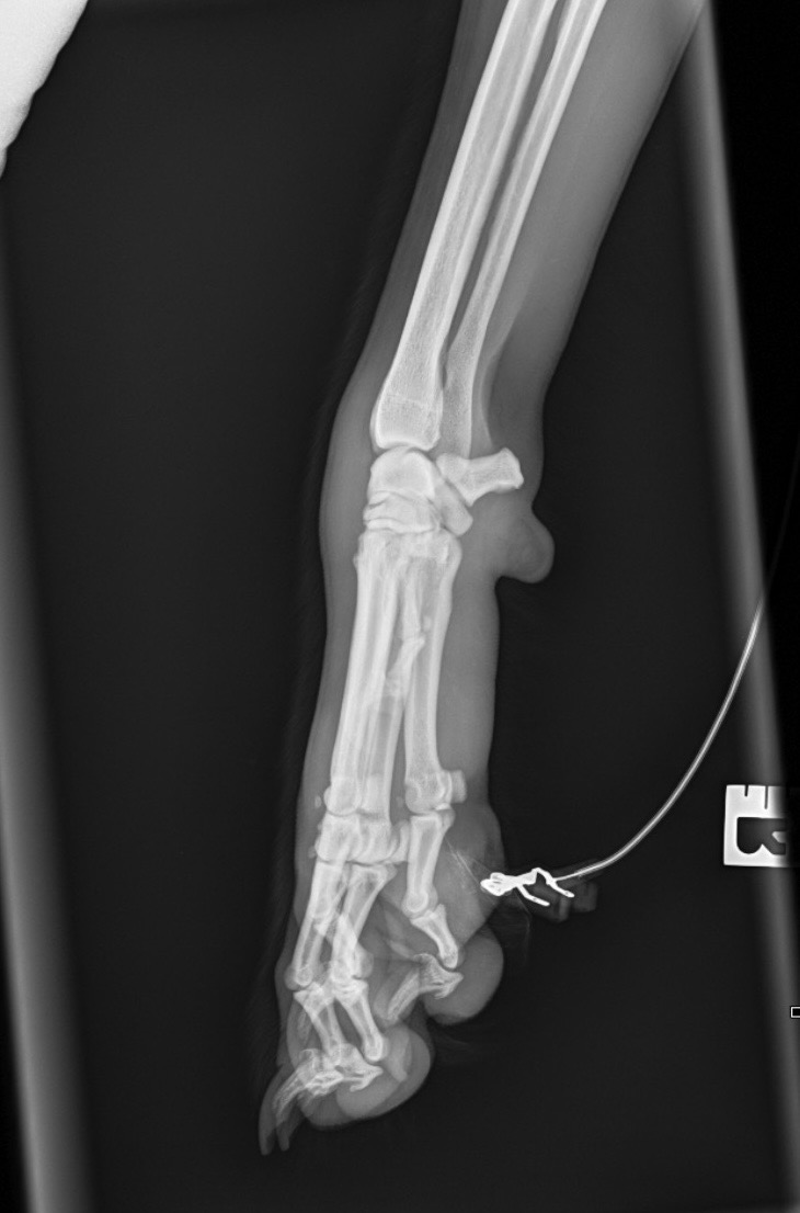 Wilson — preoperativni rendgen karpusa